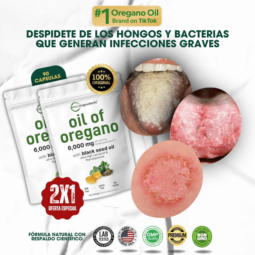 Oil of Oregano™ Elimina los parásitos ocultos en tu cuerpo desde la primera semana ¡OFERTA 2X1! 90 Cápsulas
